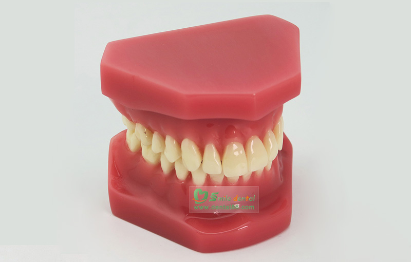 B6 Orthodontic Model